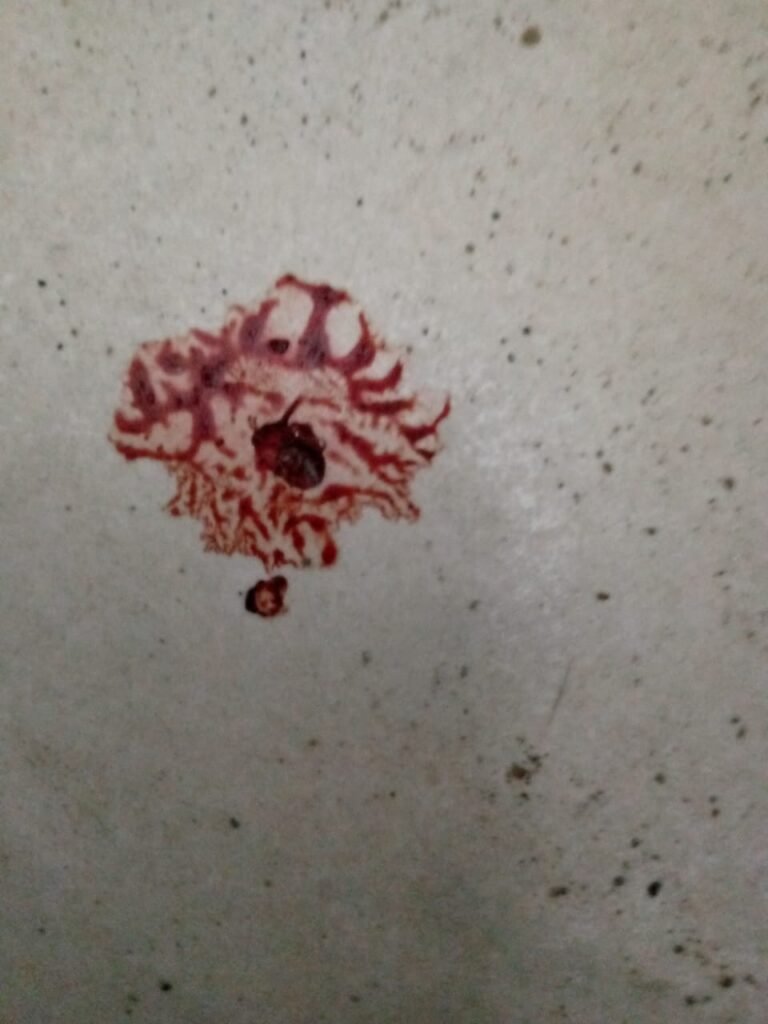 Blood on floor