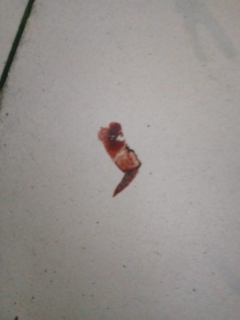 Blood on floor