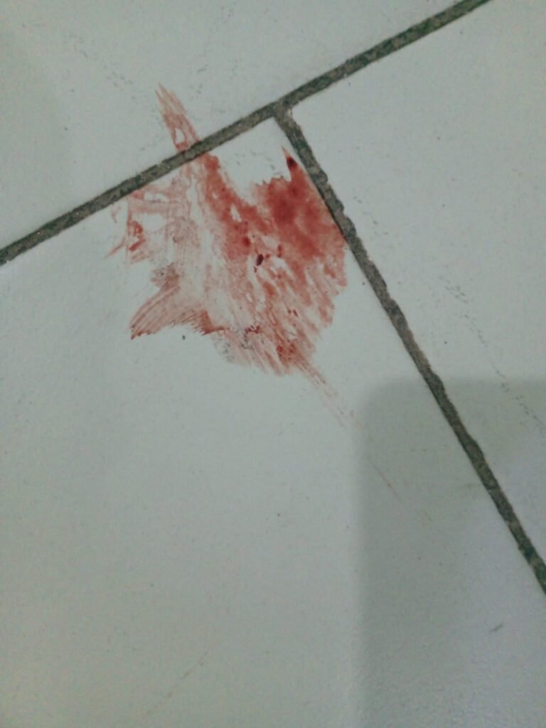 Blood on floor