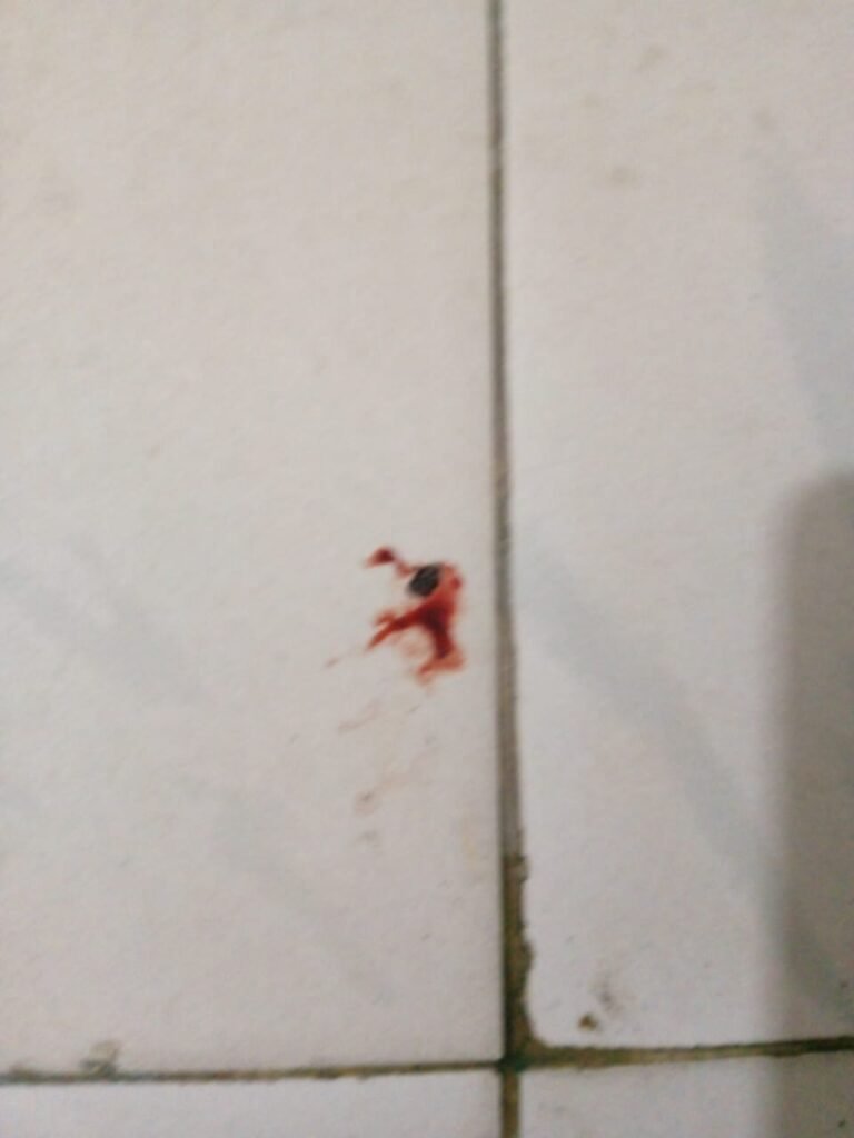 Blood on floor