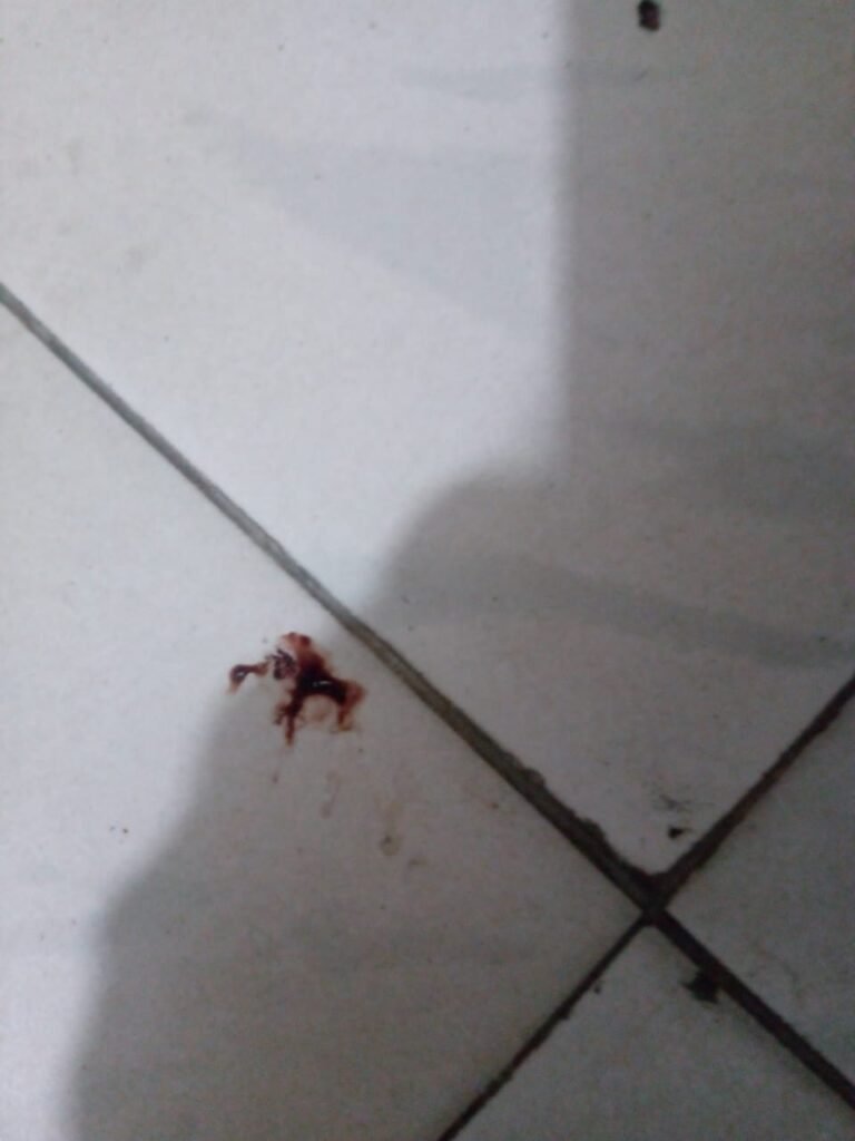 Blood on floor