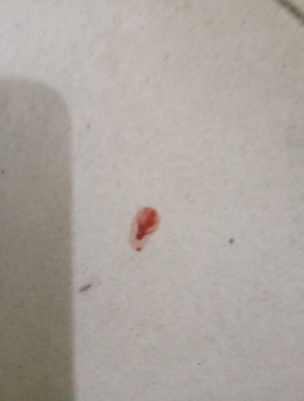 Blood on floor