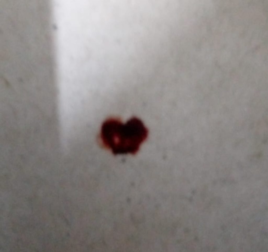 Blood on floor