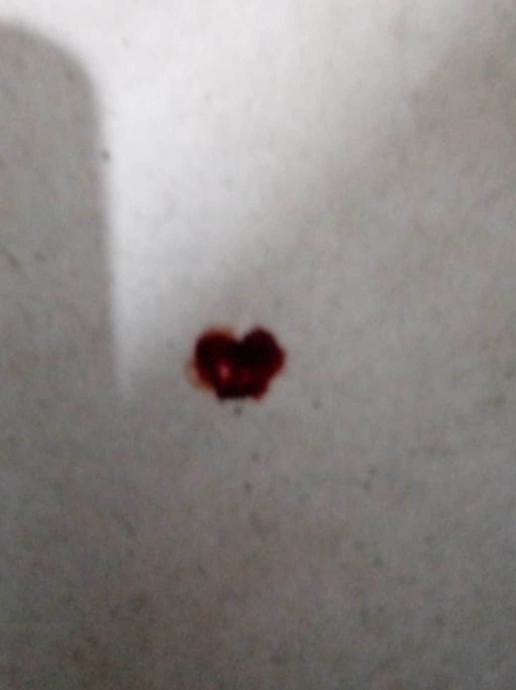 Blood on floor
