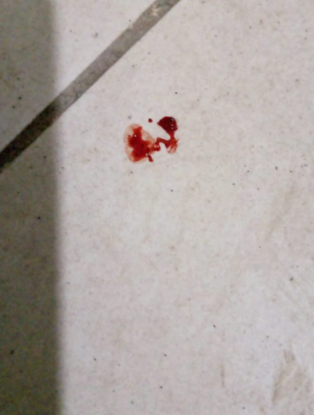 Blood on floor